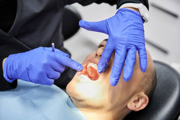 Best Knocked-Out Tooth (Avulsed Tooth) Treatment in Country Clu, MO