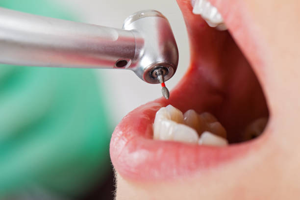 Best Emergency Pediatric Dental Care in Country Clu, MO